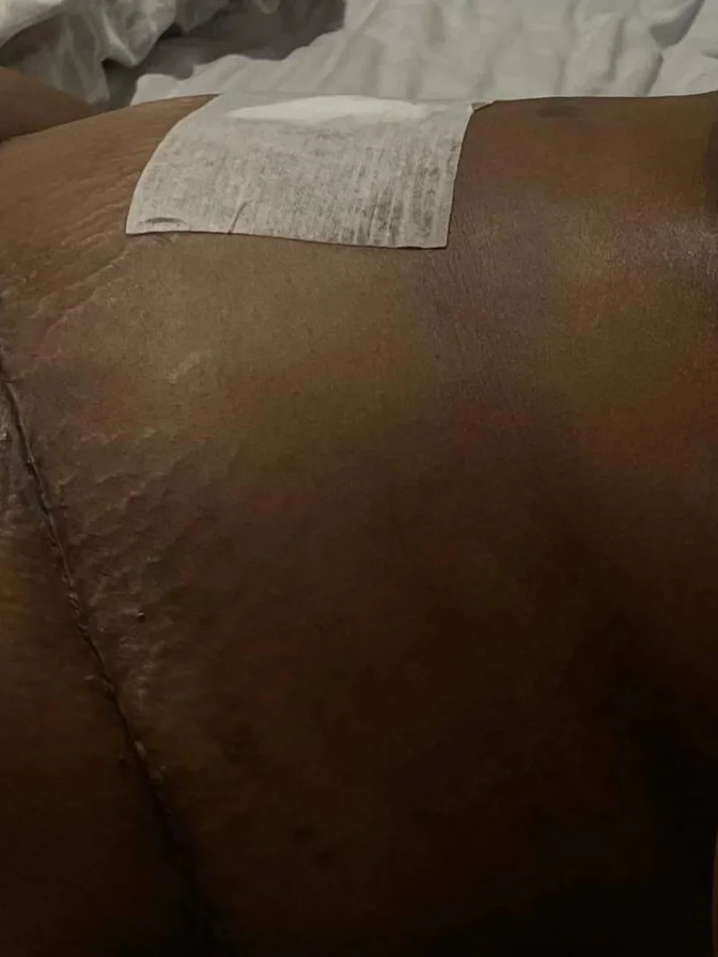 Glav Spa treatment result image 3