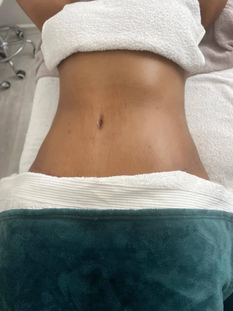 Glav Spa treatment result image 4