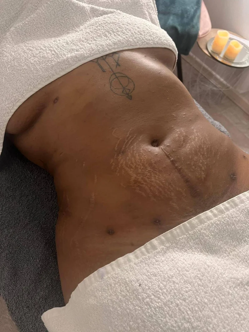 Glav Spa treatment result image 5