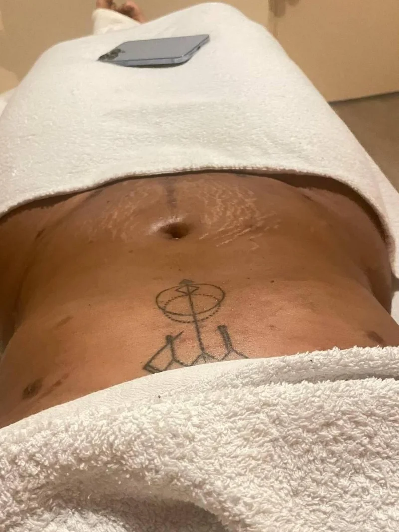 Glav Spa treatment result image 6